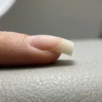 Pincer Nails