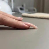 Nail Apex Placement